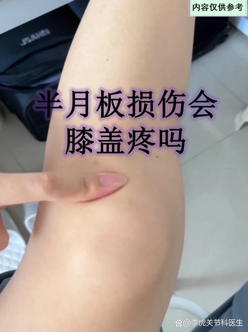 阿伦：我的膝伤仍未完全恢复跳跃和落地时膝盖还是会疼