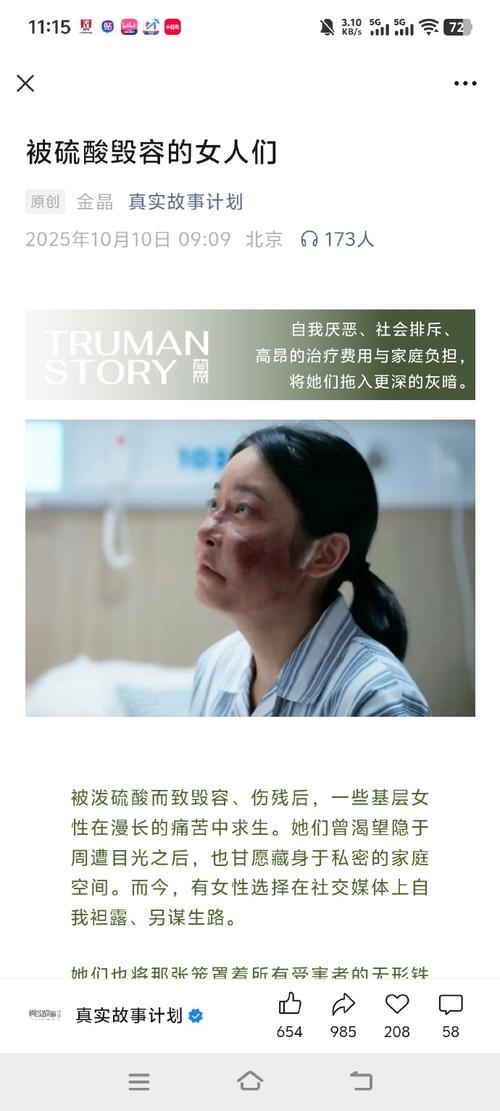 媒体人：格兰是巧妇难为无米之炊伤病问题严重影响战术执行